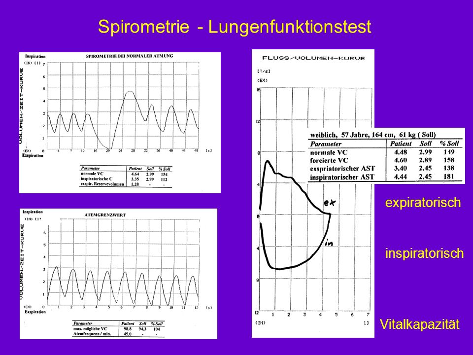 Spirometrie - Lungenfunktionstest