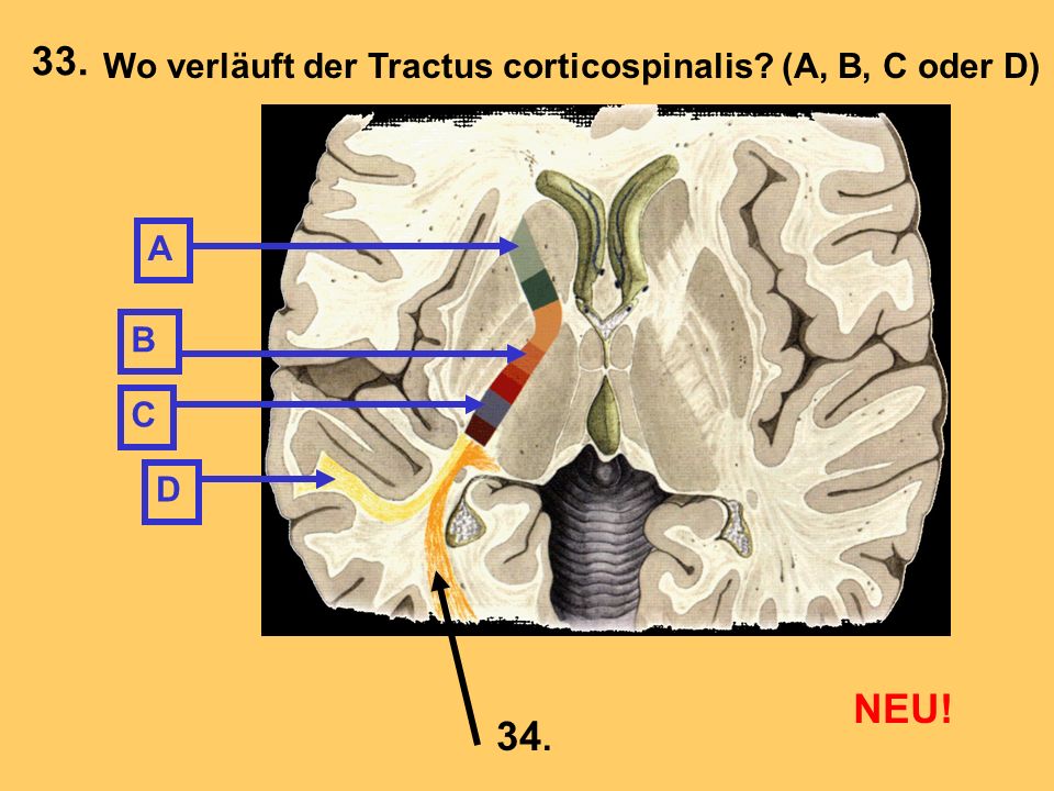 33. NEU! 34. Wo verläuft der Tractus corticospinalis (A, B, C oder D)