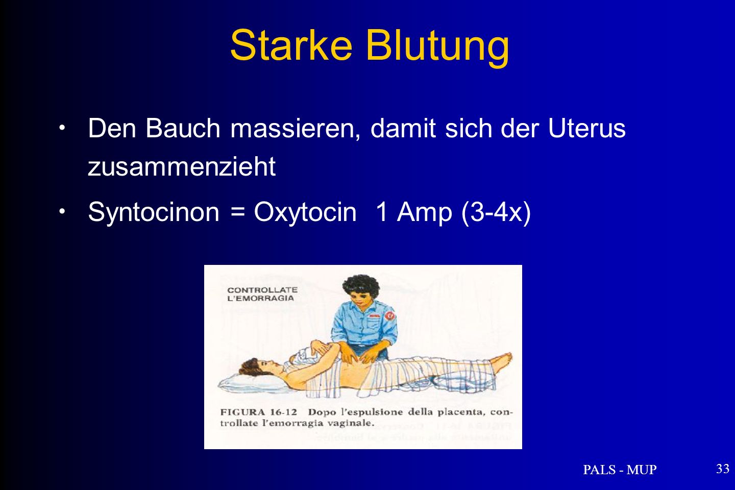Starke Blutung Den Bauch massieren, damit sich der Uterus zusammenzieht. Syntocinon = Oxytocin 1 Amp (3-4x)