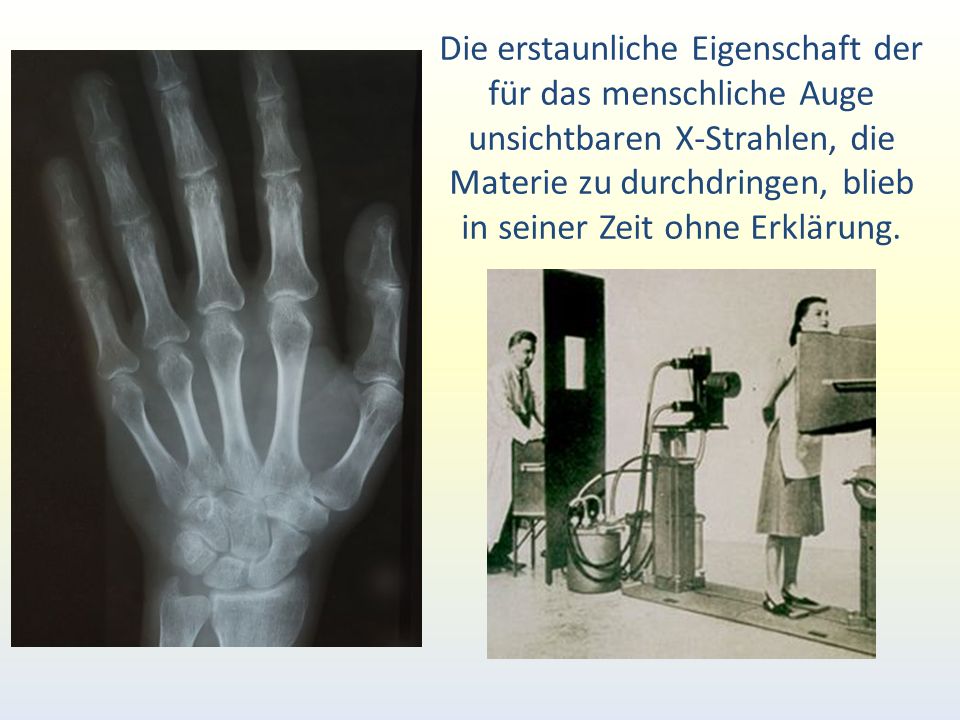 Die erstaunliche Eigenschaft der für das menschliche Auge unsichtbaren X-Strahlen, die Materie zu durchdringen, blieb in seiner Zeit ohne Erklärung.