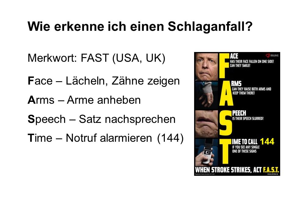 Wie erkenne ich einen Schlaganfall