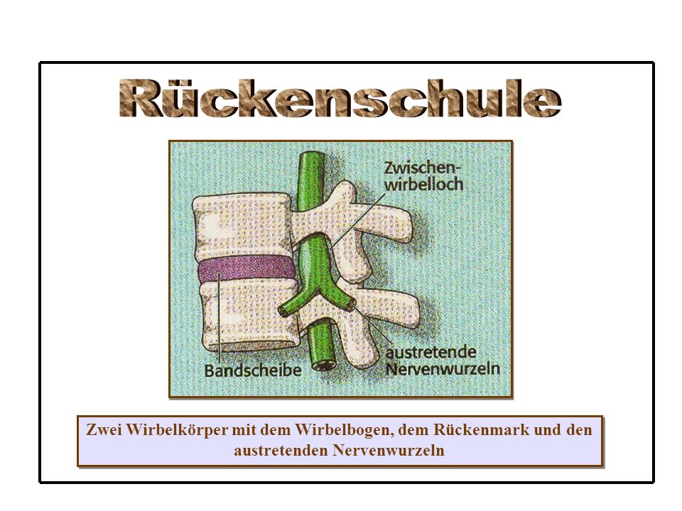 Rückenschule Zwei Wirbelkörper mit dem Wirbelbogen, dem Rückenmark und den.