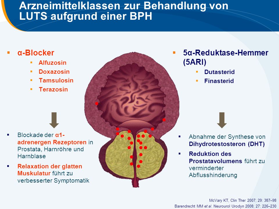 Arzneimittelklassen zur Behandlung von LUTS aufgrund einer BPH