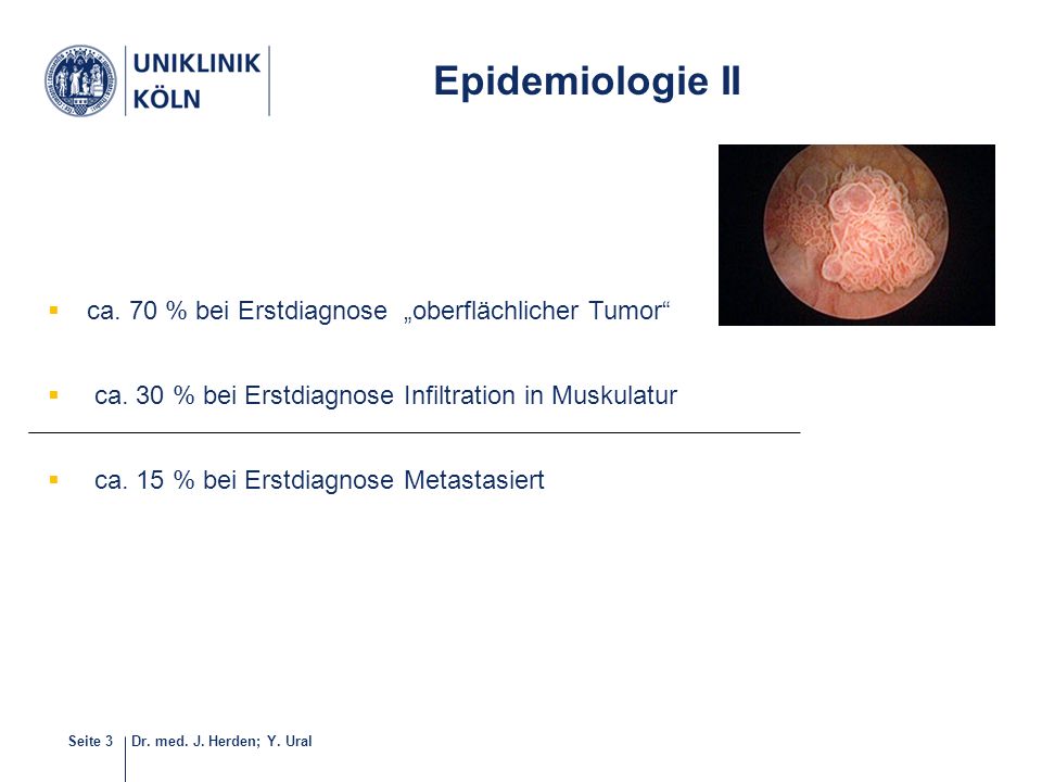 Epidemiologie II ca. 70 % bei Erstdiagnose „oberflächlicher Tumor